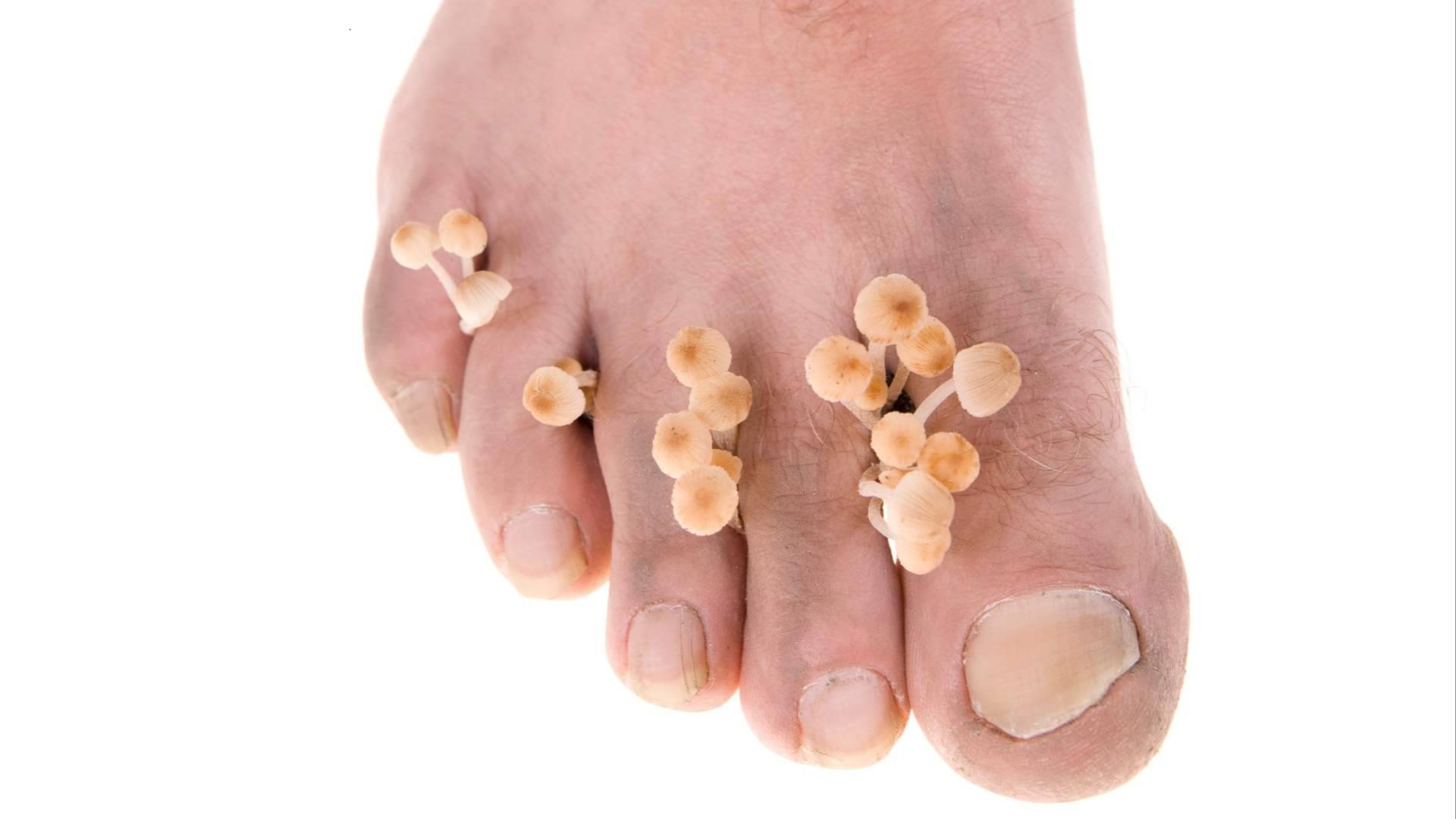 Laboratoires Bailleul aborda cómo proteger los pies durante la práctica deportiva