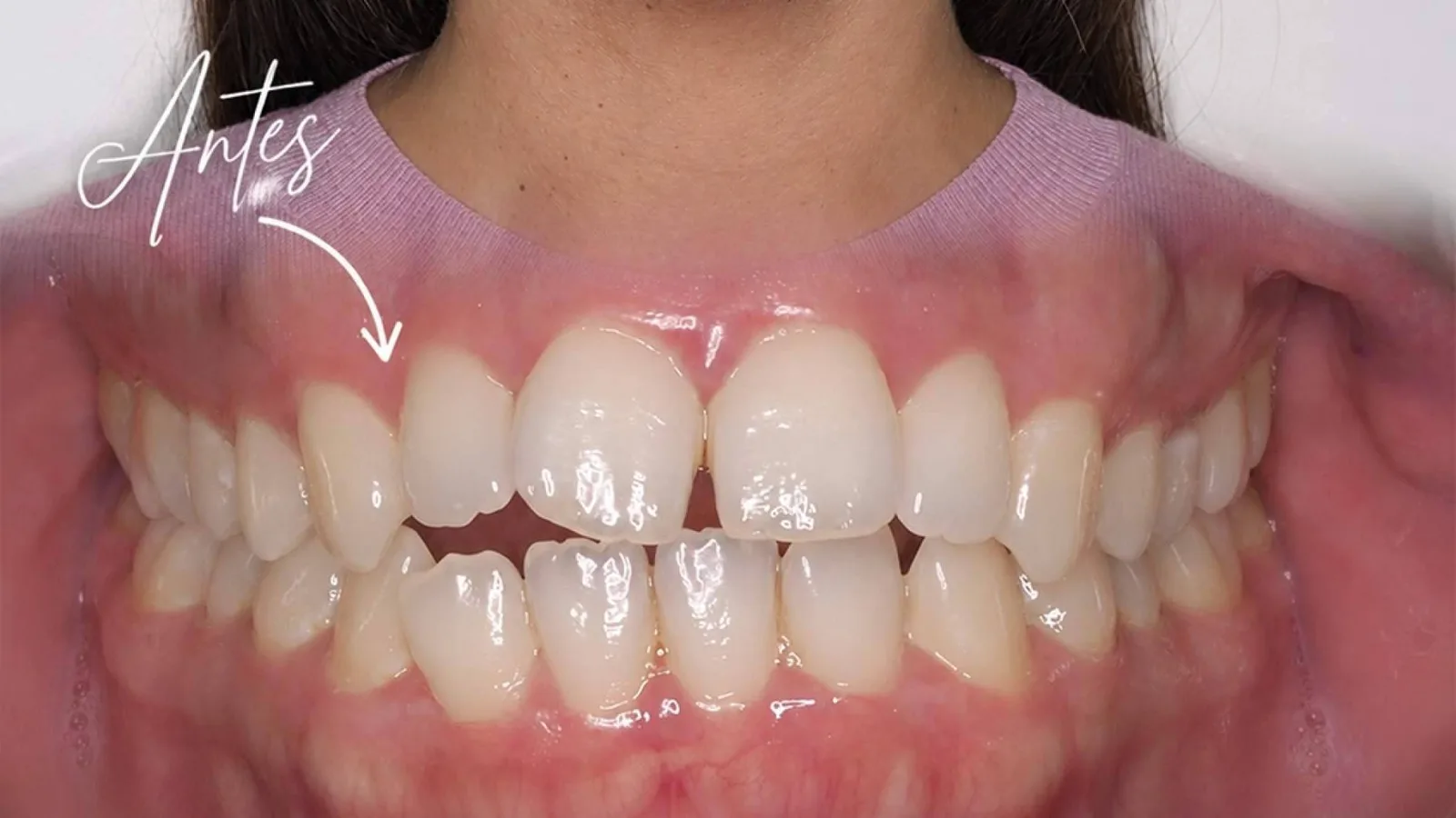 Clínica Calvo de Mora refuerza el abordaje de casos complejos con cirugía maxilofacial e implantología avanzada